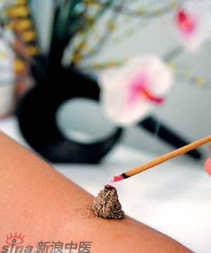 節(jié)氣灸” 冬至，你灸了嗎？